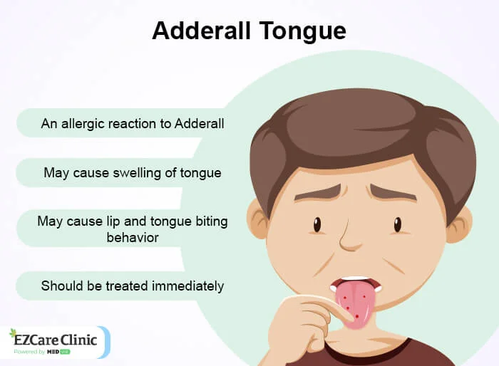 How long does adderall tongue last